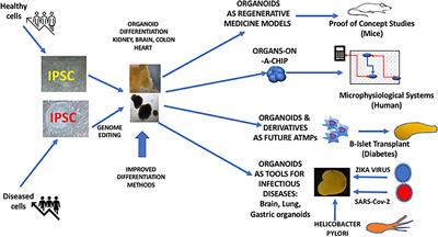 iPSC-Derived Organoids as Therapeutic Models in Regenerative Medicine and Oncology